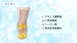足の痛み　後