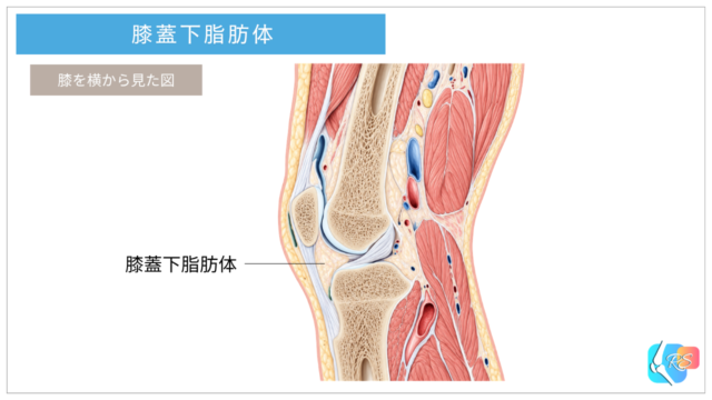 膝蓋下脂肪体の位置を示した膝関節の解剖イラスト
