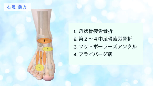 足の痛み　足の甲　足の前側