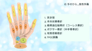 手のひら　ケガ　舟状骨骨折
