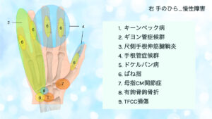 手のひら　ケガ　TFCC損傷