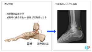 どのように扱われますか?