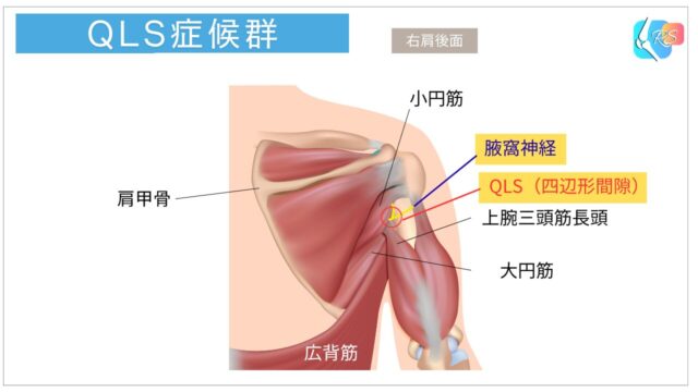 肩QLS症候群　四辺形間隙　腋窩神経　解剖図