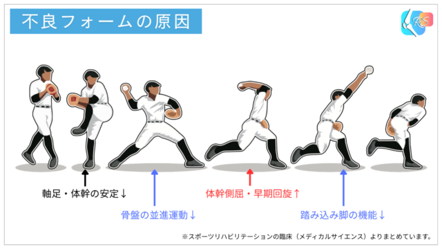 投球動作の各フェーズのエラーが連鎖して不良フォームを生じる流れを示した図