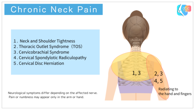 Chronic neck pain caused by postural stress and overuse