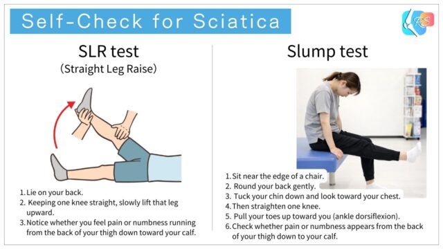 Self-Check for Sciatica
Straight Leg Raise (SLR) Test
Slump Test
