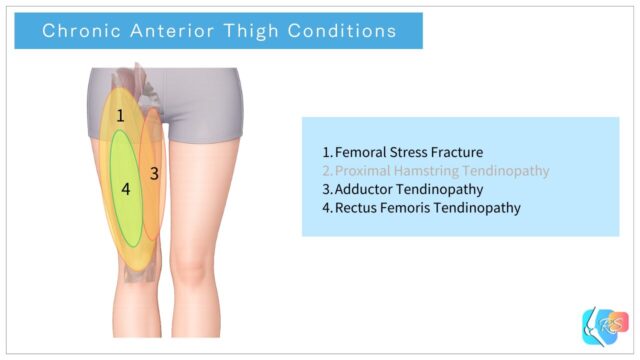 Chronic anterior thigh conditions including femoral stress fracture, proximal hamstring tendinopathy, adductor tendinopathy, and rectus femoris tendinopathy