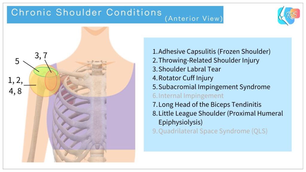 Shoulder Pain and Injuries: Common Causes in Sports and Daily Life