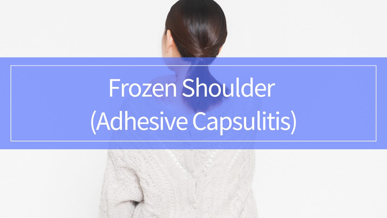 Frozen Shoulder (Adhesive Capsulitis): Symptoms, Treatment Options, and Stage-Based Rehabilitation