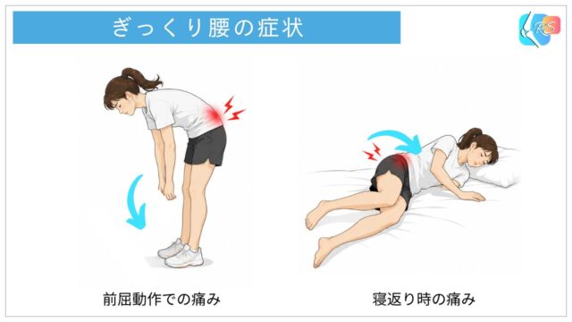ぎっくり腰で前屈動作や寝返り動作の際に腰痛が生じる様子を示したイラスト