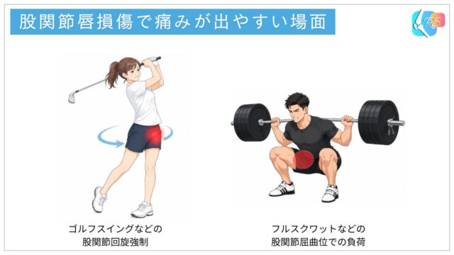 股関節唇損傷で痛みが出やすい動作のイラスト:ゴルフスイングの回旋動作とフルスクワットによる深い股関節屈曲