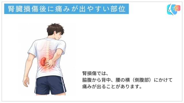 腎損傷で痛みが出やすい部位（脇腹・背中・腰の横）を示したイラスト