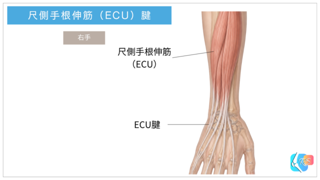 尺側手根伸筋（ECU）とECU腱の走行を示した前腕・手関節背側の解剖イラスト