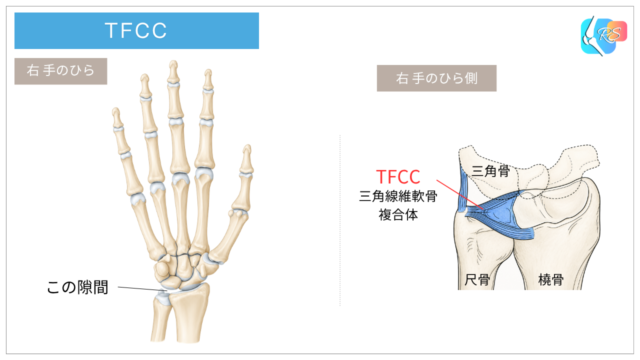 TFCC(三角線維軟骨複合体)の位置と、手首の小指側にある橈骨・尺骨・手根骨との関係を示した解剖イラスト
