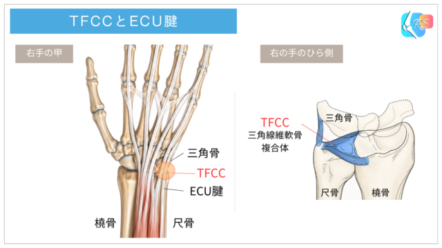 TFCC(三角線維軟骨複合体)と尺側手根伸筋(ECU)腱の位置関係を示した手首小指側の解剖イラスト