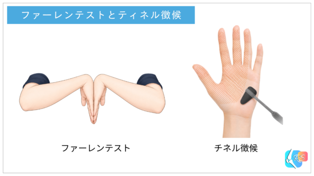 手根管症候群を評価するファーレンテストとティネル徴候の方法を示したイラスト