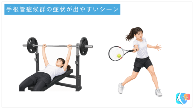 手根管症候群の症状が出やすいシーンとして、ベンチプレスとテニスのフォアハンド動作で手首や手への負担がかかる場面を示したイラスト
