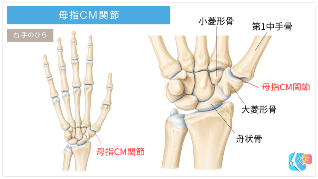 母指CM関節の解剖図。第1中手骨と大菱形骨の位置、親指の付け根にある母指CM関節を示したイラスト