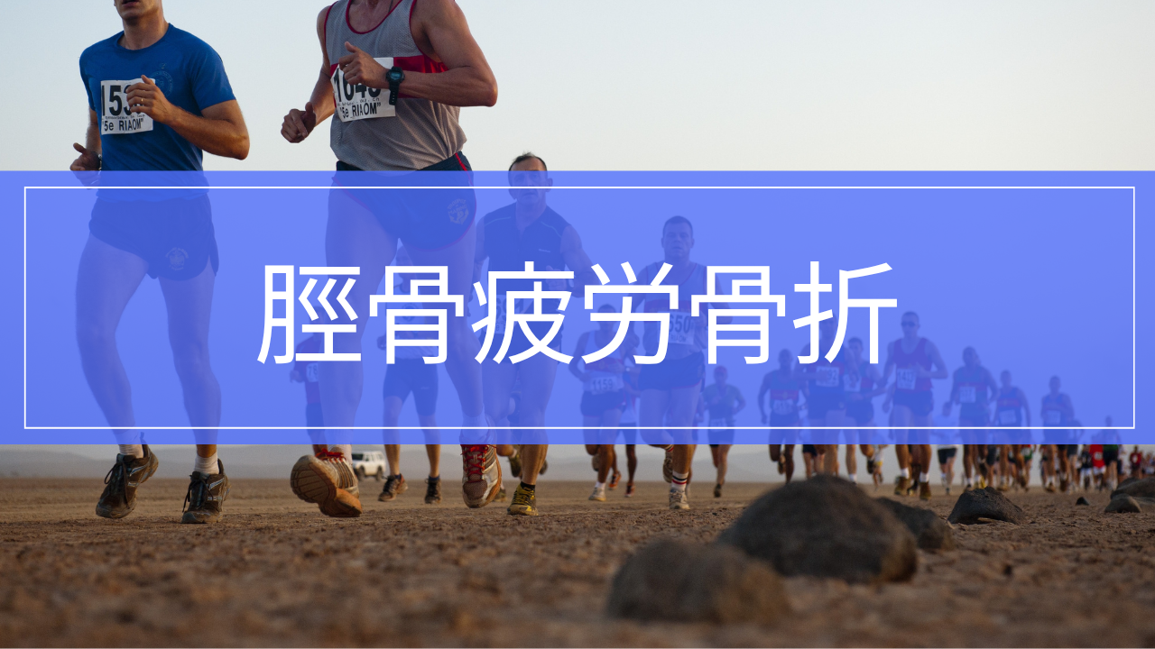 脛骨疲労骨折|症状・検査・治療・リハビリと復帰の目安