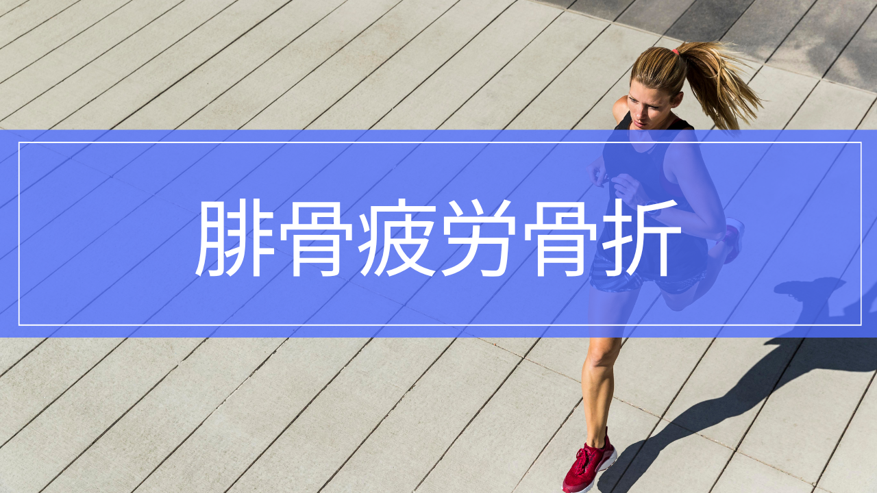 腓骨疲労骨折|すねの外側が痛い原因・治療・リハビリと復帰