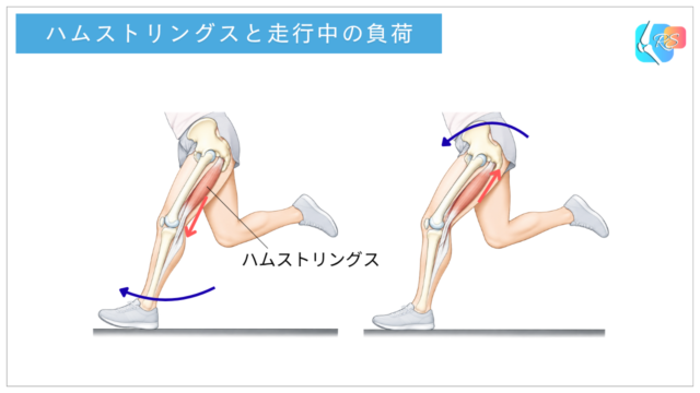 ハムストリングスへの伸張ストレスを示す図。膝関節の強制伸展と骨盤の前傾によって太もも裏の筋肉が引き伸ばされる仕組み